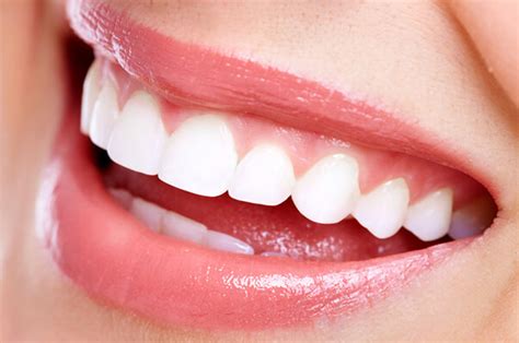 Teeth Straightening Treatment in Andheri East - AndheriSmiles