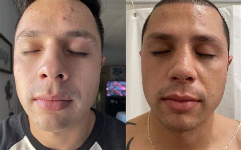 Amazing Before-After Pictures Reveals Jaw-Dropping Results!