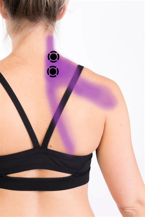 Levator Scapulae Summary – Komizo Diagnostics