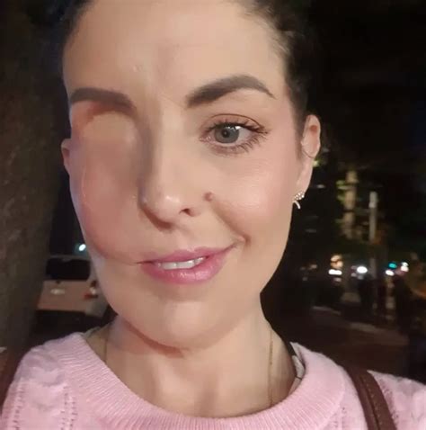 life saving procedure  woman  lost  eye describes