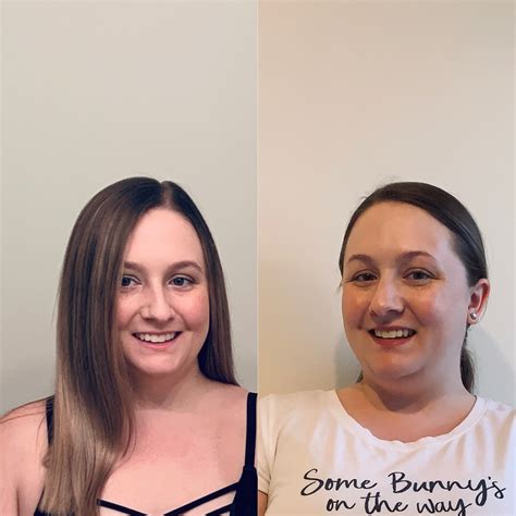 how to make swelling on face go down 1