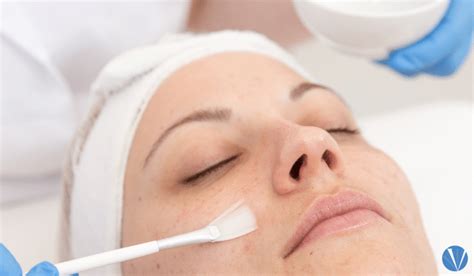 Chemical Peel Aftercare Guide | Vujevich Dermatology Associates