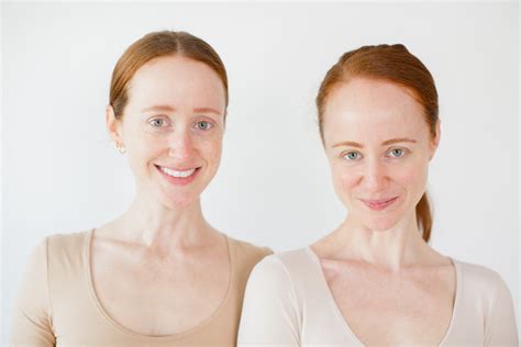 5 conseils de soins de la peau d'hiver soutenus par des experts pour