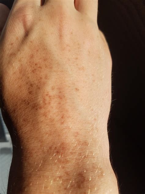 skin concerns weird spots    hand