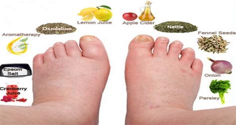 Home Remedies For Water Retention – HEALTHY FOOD ADVICE
