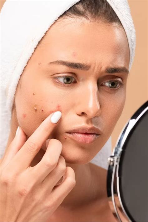 Fast Fix: Eradicating Acne Spots In 3 Simple Home Remedies