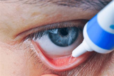 13 Conjunctival Sac Royalty-Free Images, Stock Photos & Pictures ...
