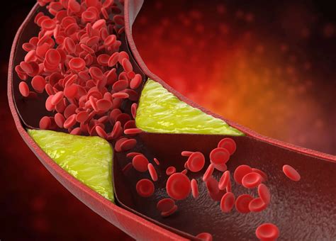 Cholesterol Clarity What The Hdl Is Wrong With My Numbers 9
