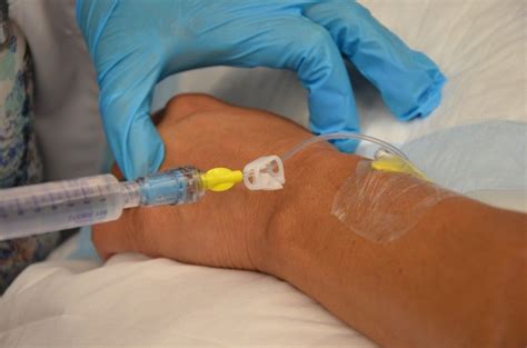 8.5 Flushing a Saline Lock and Converting a Saline Lock to a Continuous IV Infusion – Clinical ...