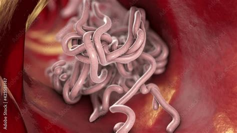 parasitic worms   lumen   lumen  animation growth