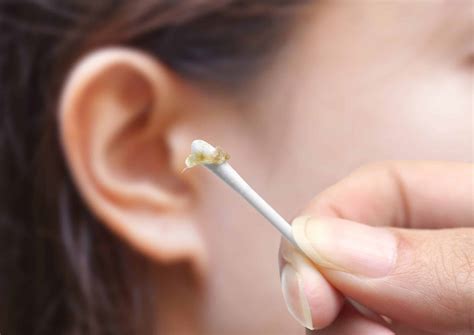 Ear Wax Removal By Doctor