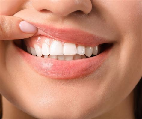 White Gums: 13 Causes & Super Effective Prevention Tips - KWC Dental