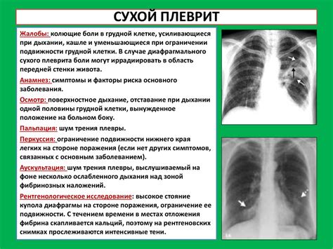 Анализ мокроты и плеврального выпота - презентация онлайн
