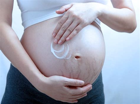 Barriga De Gravida Com Estrias - Estrias Gravidas Afinal, é Possível Ficar Livre De Estrias Na