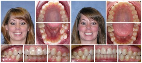 InfluencerGoneWild's Biggest Transformation YET: Before & After Photos Image 11