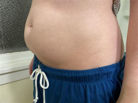 Anyone else have bloating like this, constantly? I just had homemade