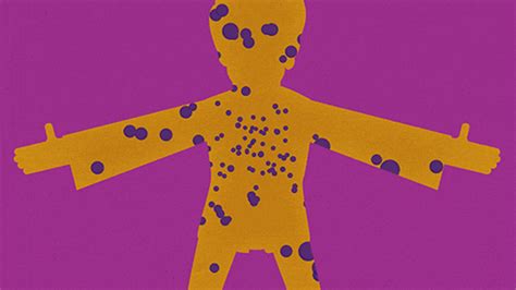 fight or flight norepinephrine gif | WiffleGif