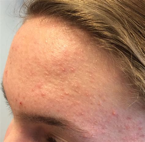 Pin on skin care