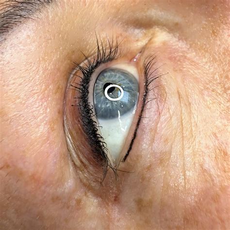 How Long Does Swelling Last After Permanent Eyeliner?