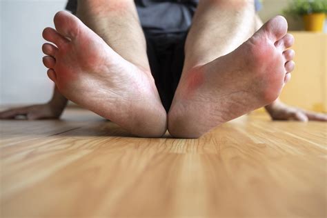Finding Relief for Neuropathy in Your Feet: Effective Treatments and