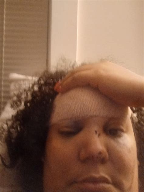 Chisel vs finger : r/injuries