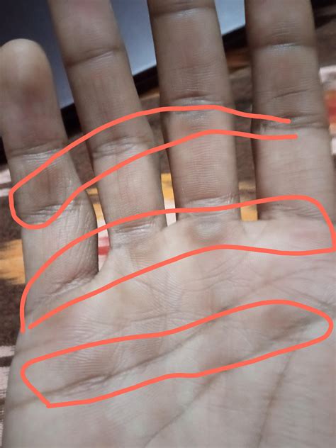 How To Wrap Calloused Hands at Genevieve Tarrant blog