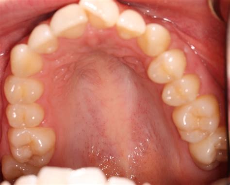 Case Gallery - Patient Transformations | Inspire Dental