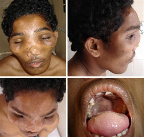 10 Scariest Diseases In The World - Elite Facts