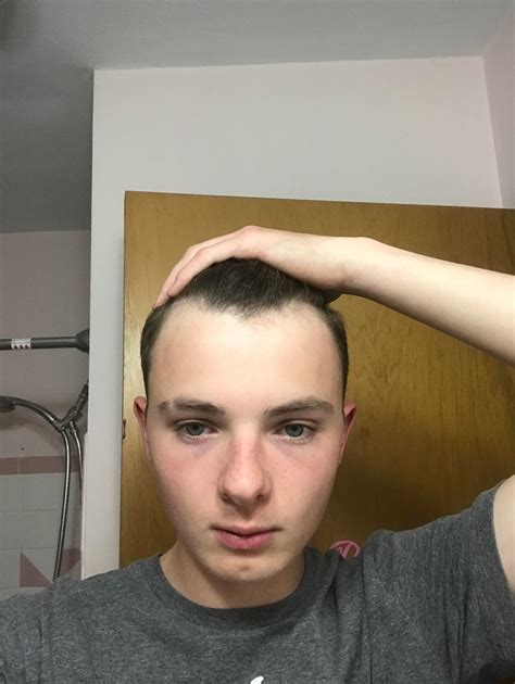 16, am I balding/is my forehead big : r/malehairadvice