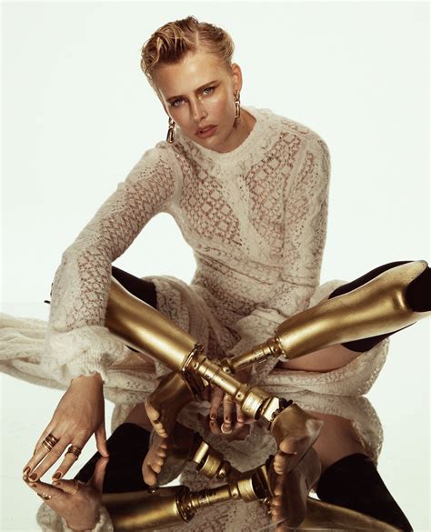 Lauren Wasser im Interview: “Alles ist möglich – auch nach schweren