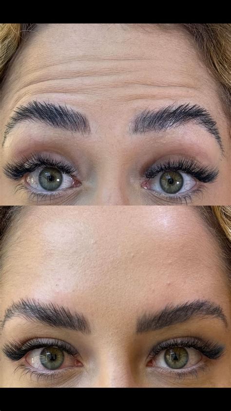 Dra. Amanda Ohanna | Biomédica Esteta (@dra.amandaohanna) • Instagram