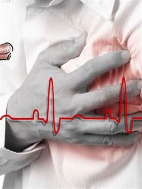 chest pain  arent heart attack