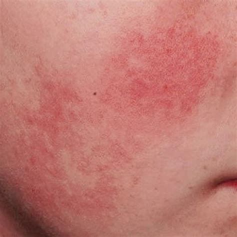 negative science backed skincare  sensitive indian skin
