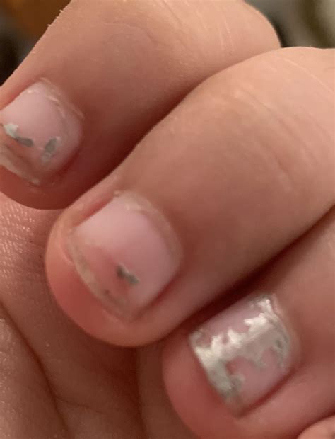 Why do my nails look like this? This is after acrylics and picking off