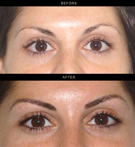 Permanent Eyeliner Photos Los Gatos, Bay Area Timeless Skin Spa