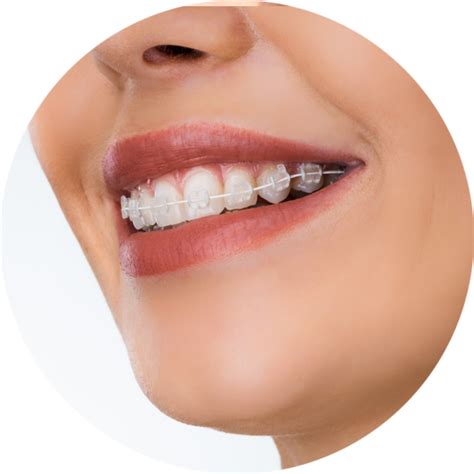 clear braces columbus ohio hutta price orthodontics