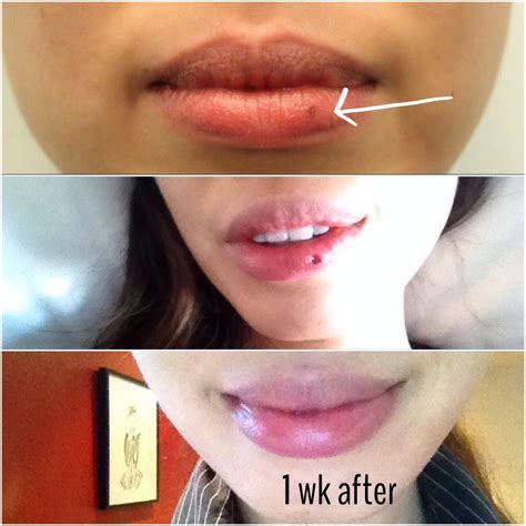 Lipstube: How To Get The Most Out Of It