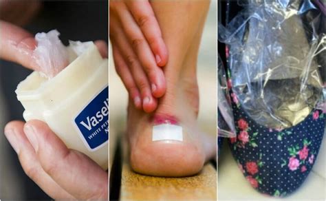 Como Acabar Com Calos Nos Pés - Eliminar calos dos pés: veja como com remédios caseiros