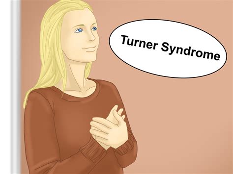 Turners Syndrome Ultrasound at Stanley Blake blog