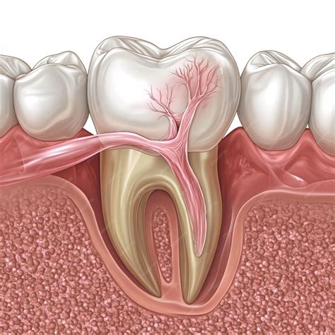 Apos Extração De Dente Quanto Tempo Para Cicatrizar - Uma ilustração mostrando o processo de cicatrização após uma extração ...