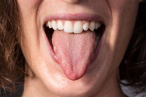 4 Things To Always Remember: About Your Tongue! | Overland Park, KS
