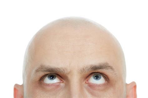 calling  bald headed  workplace  britain   considered