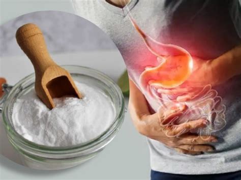Bicarbonato É Bom Para O Estômago - Cómo tomar bicarbonato para eliminar los gases y la acidez estomacal