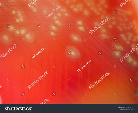 Alpha Hemolysis On Blood Agar Plate Stock Photo 1020756727 | Shutterstock