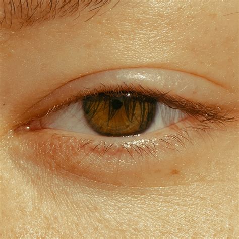You Asked Why Does My Eyelid Twitch At Random Times When To Worry