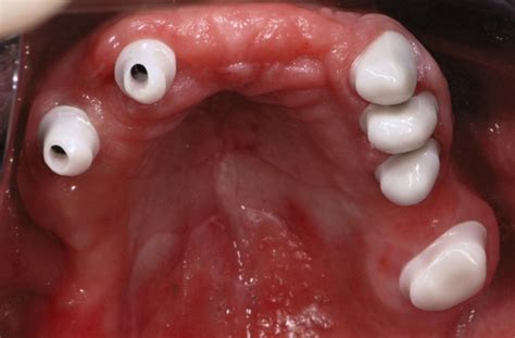 dent update: Das bieten die Veranstaltungen - dentalmagazin.de
