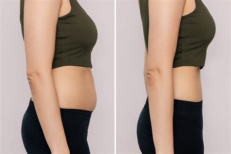 Bloated Belly Before And After