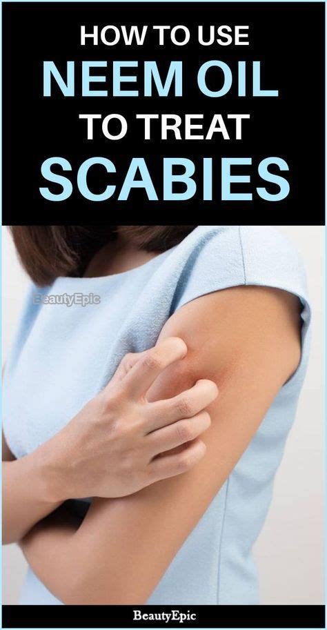 7 Scabies treatment ideas in 2021 | scabies treatment, scabies, treatment