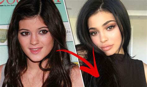Kylie Jenner plastic surgery: Before and after | Express.co.uk