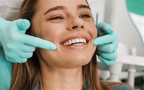 veneers shade selection tips